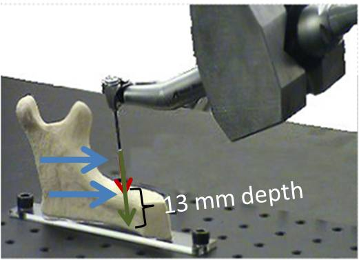 Robotic Dental System Architecture